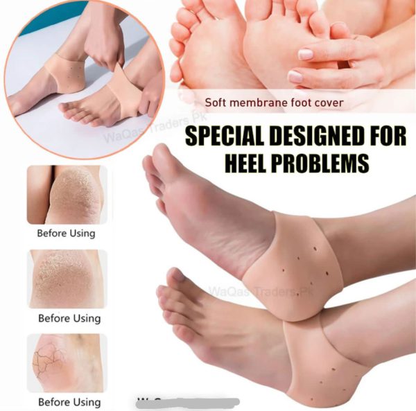 Heel Pain Anti-crack Silicone Set